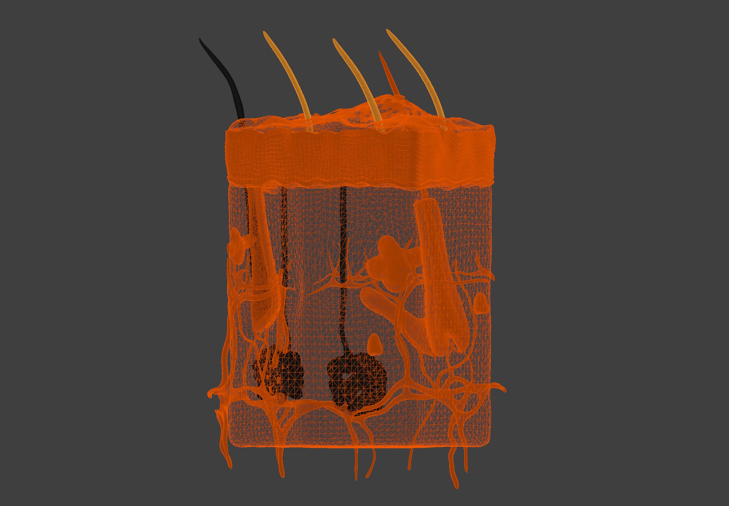 3D Model of Psoriasis Skin - Cross Section 3D print model_4