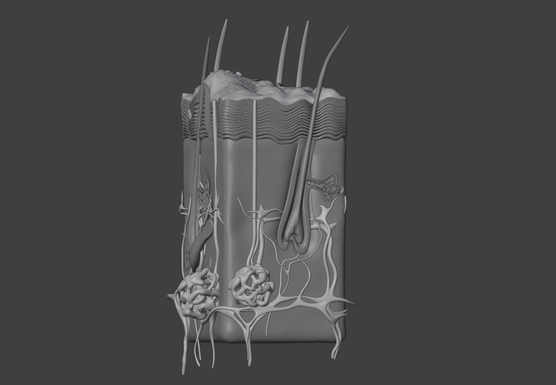 3D Model of Psoriasis Skin - Cross Section 3D print model_11