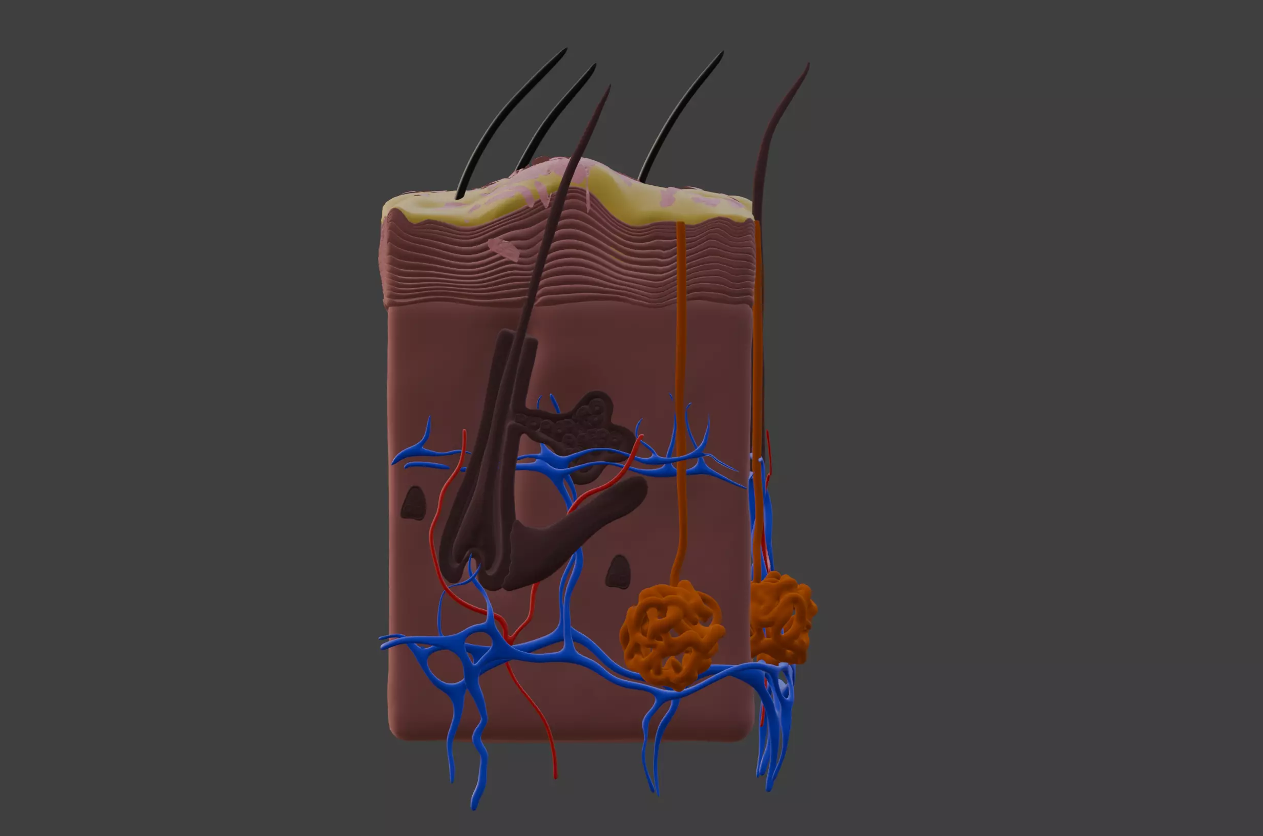 3D Model of Psoriasis Skin - Cross Section 3D print model_0