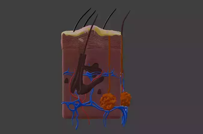 3D Model of Psoriasis Skin - Cross Section 3D print model