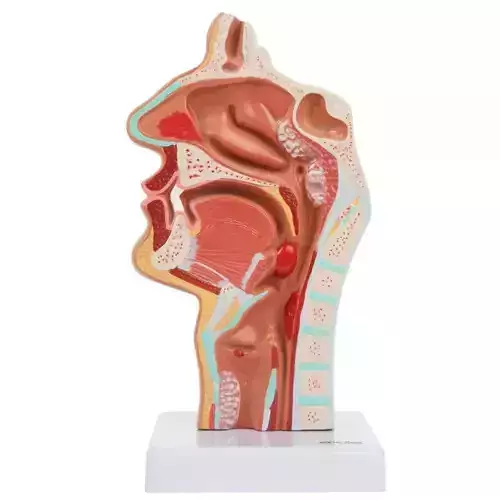 3D Model of Larynx and Pharynx Disorders 3D print model