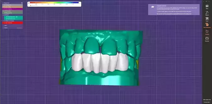 Precision Dental Bridge  CNC  3D Print Ready 3D print model