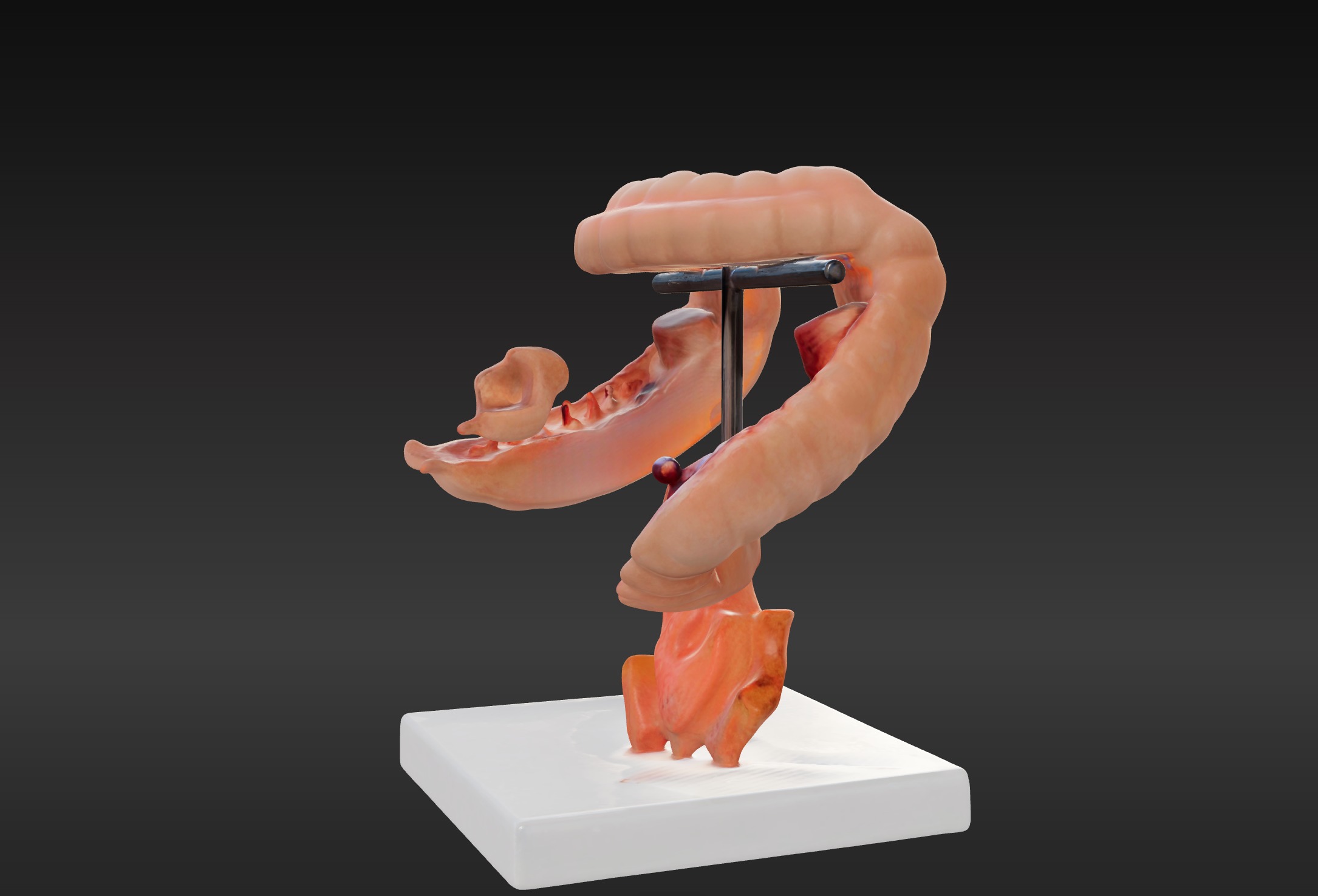  3D Model fo Intestinal Diseases 3D print model_1