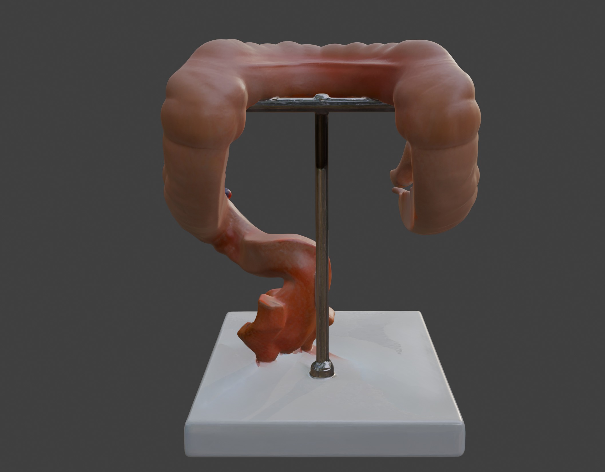  3D Model fo Intestinal Diseases 3D print model_8