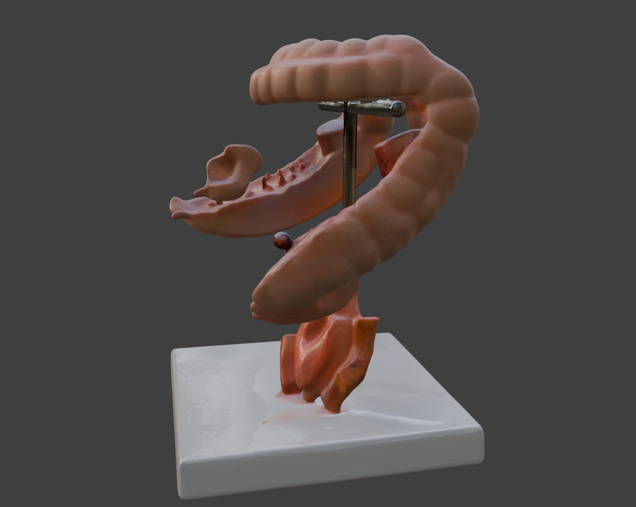  3D Model fo Intestinal Diseases 3D print model_7