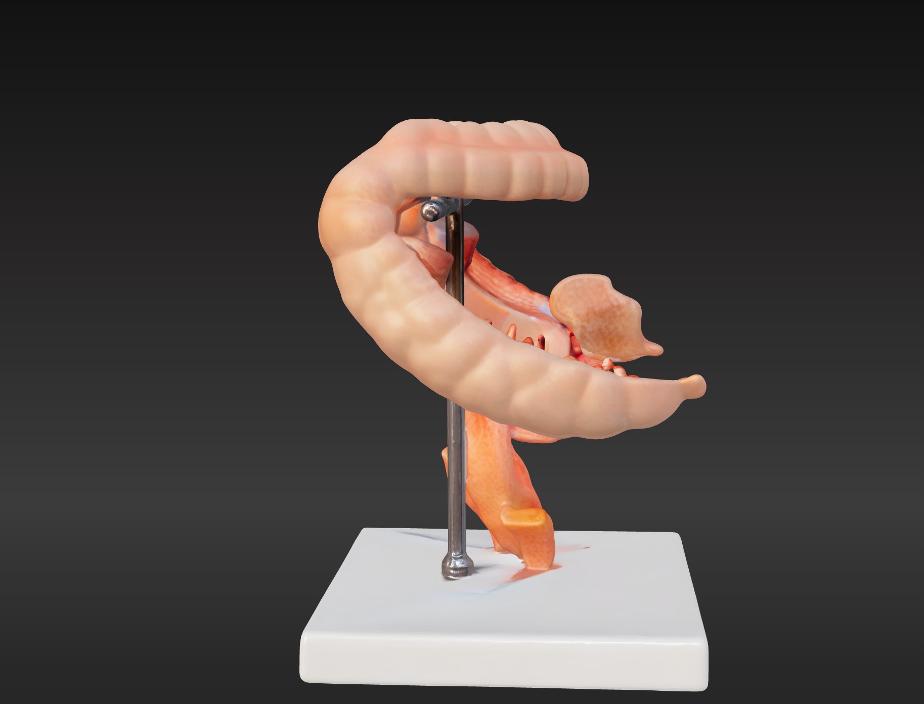  3D Model fo Intestinal Diseases 3D print model_5