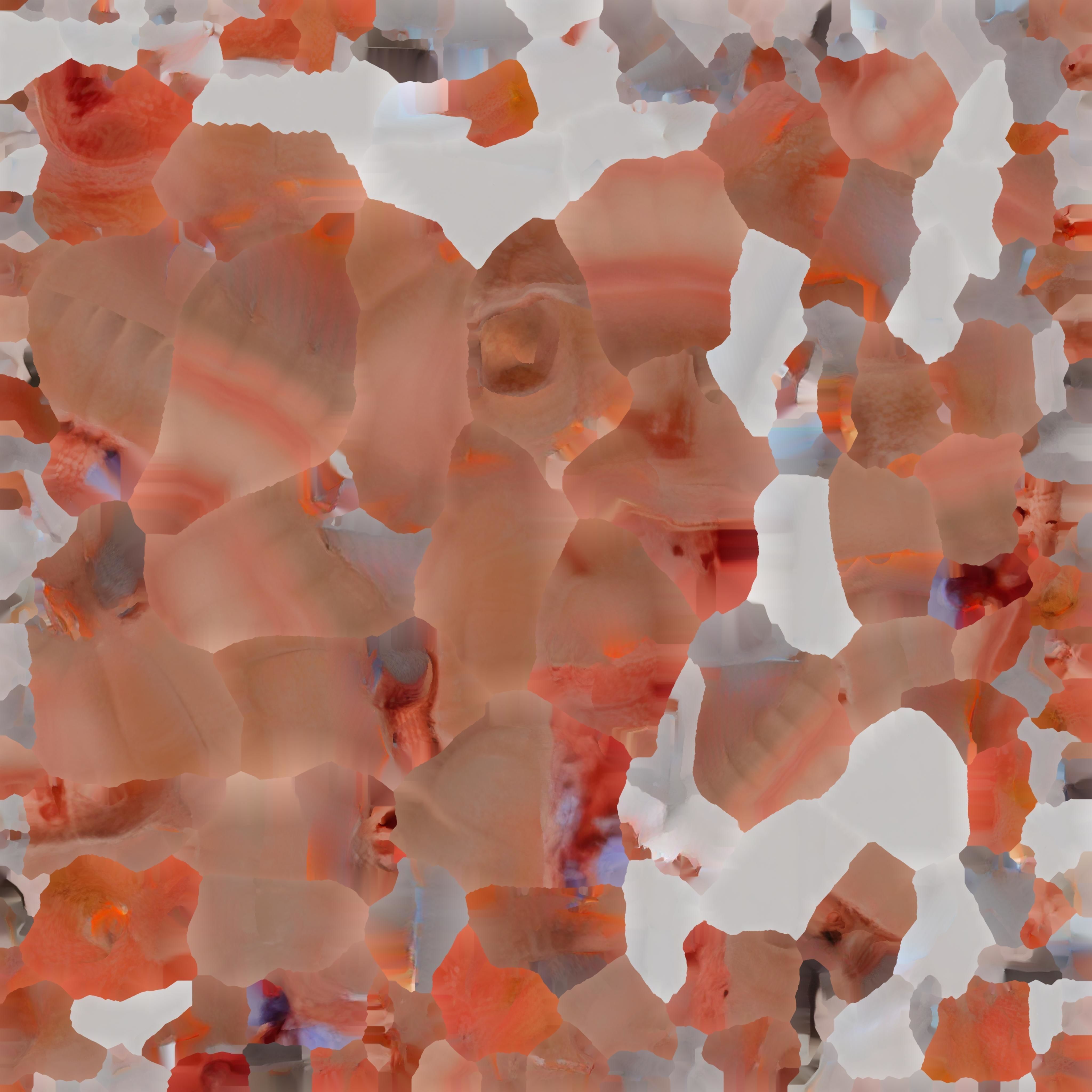  3D Model fo Intestinal Diseases 3D print model_15