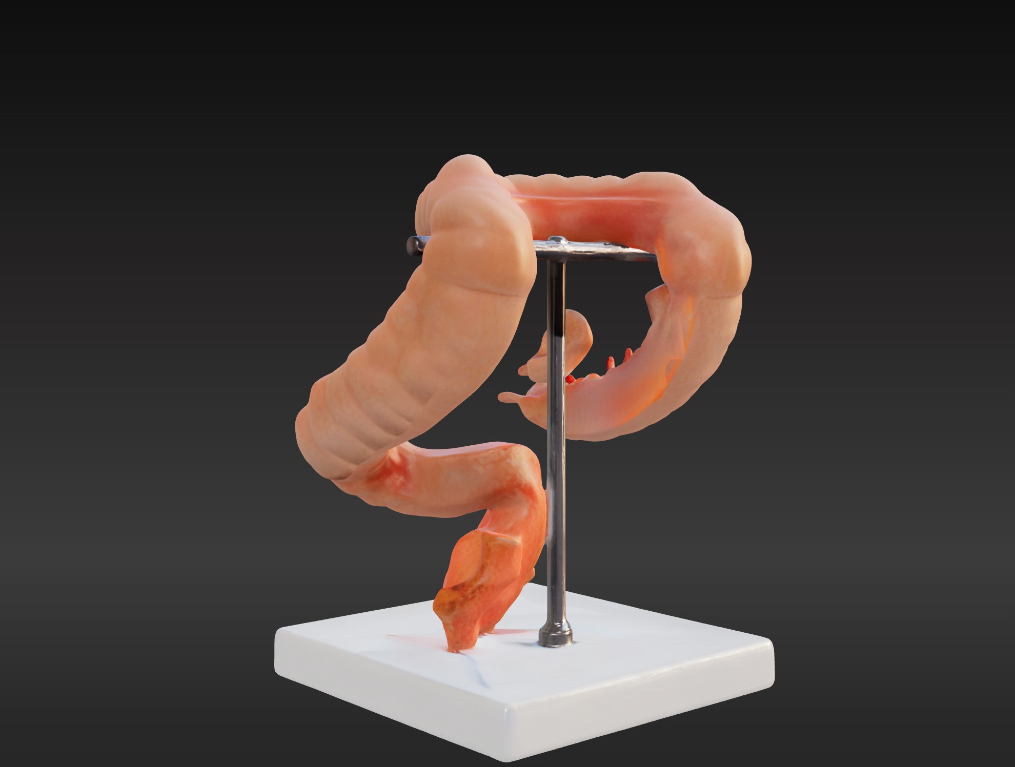 3D Model fo Intestinal Diseases 3D print model_2