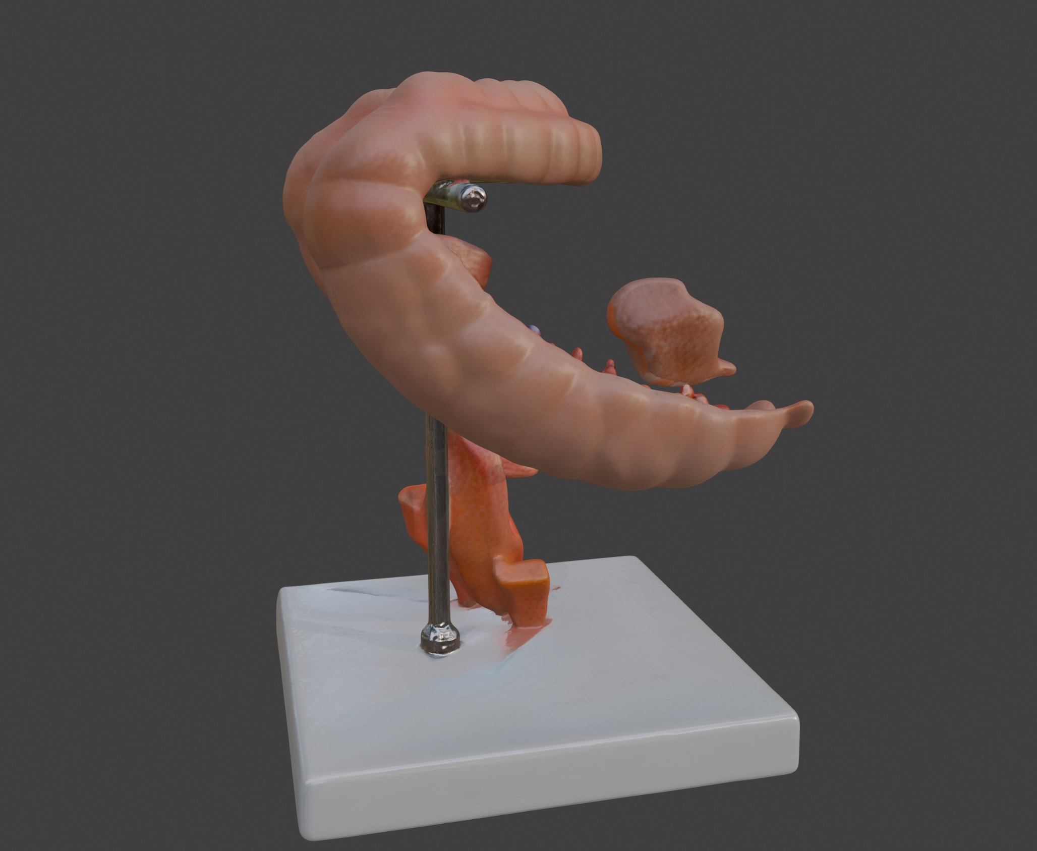  3D Model fo Intestinal Diseases 3D print model_3