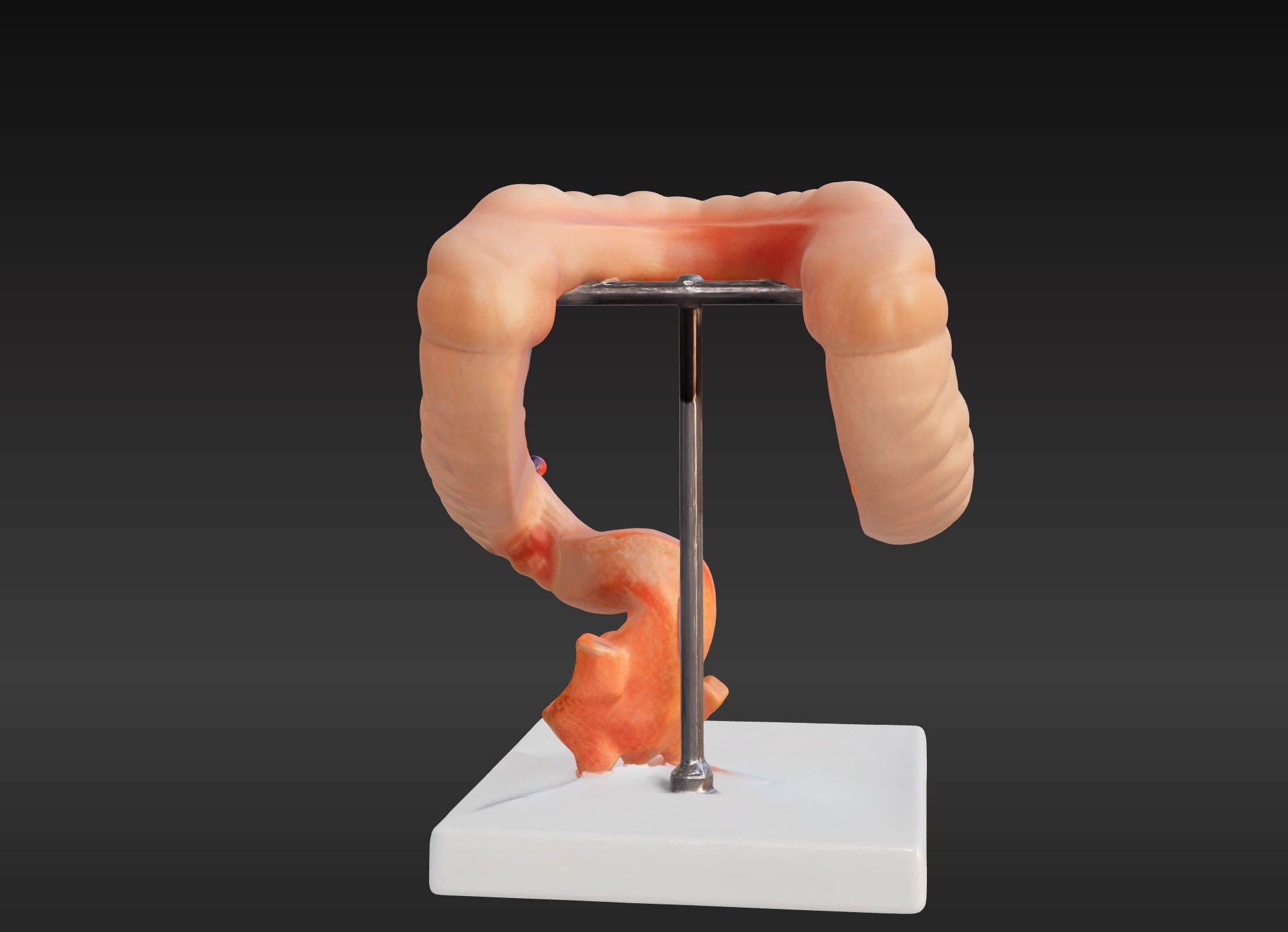  3D Model fo Intestinal Diseases 3D print model_4