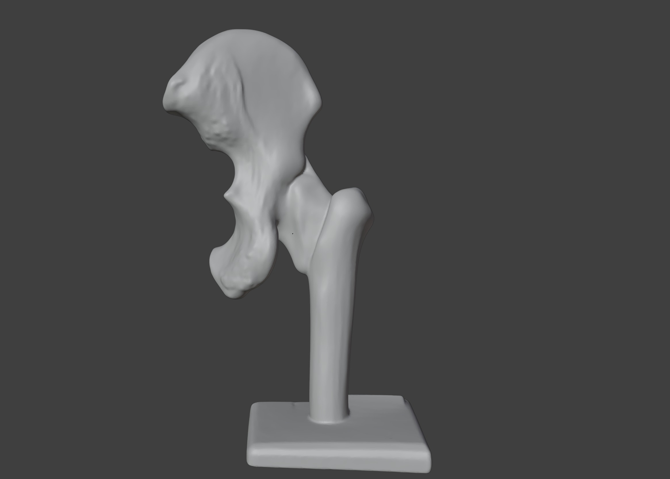 3D Hip Joint Anatomy Model 3D print model_9