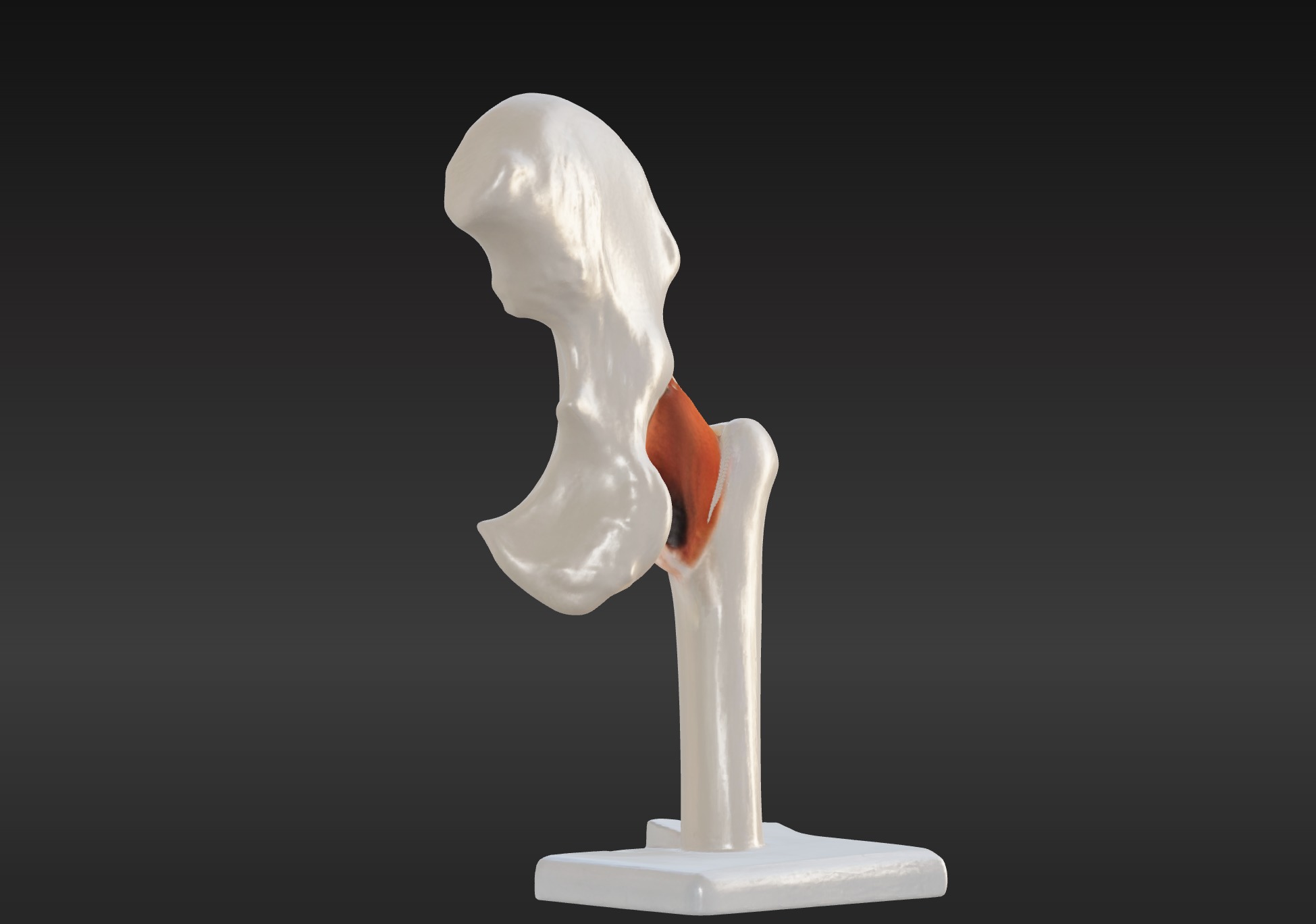 3D Hip Joint Anatomy Model 3D print model_2