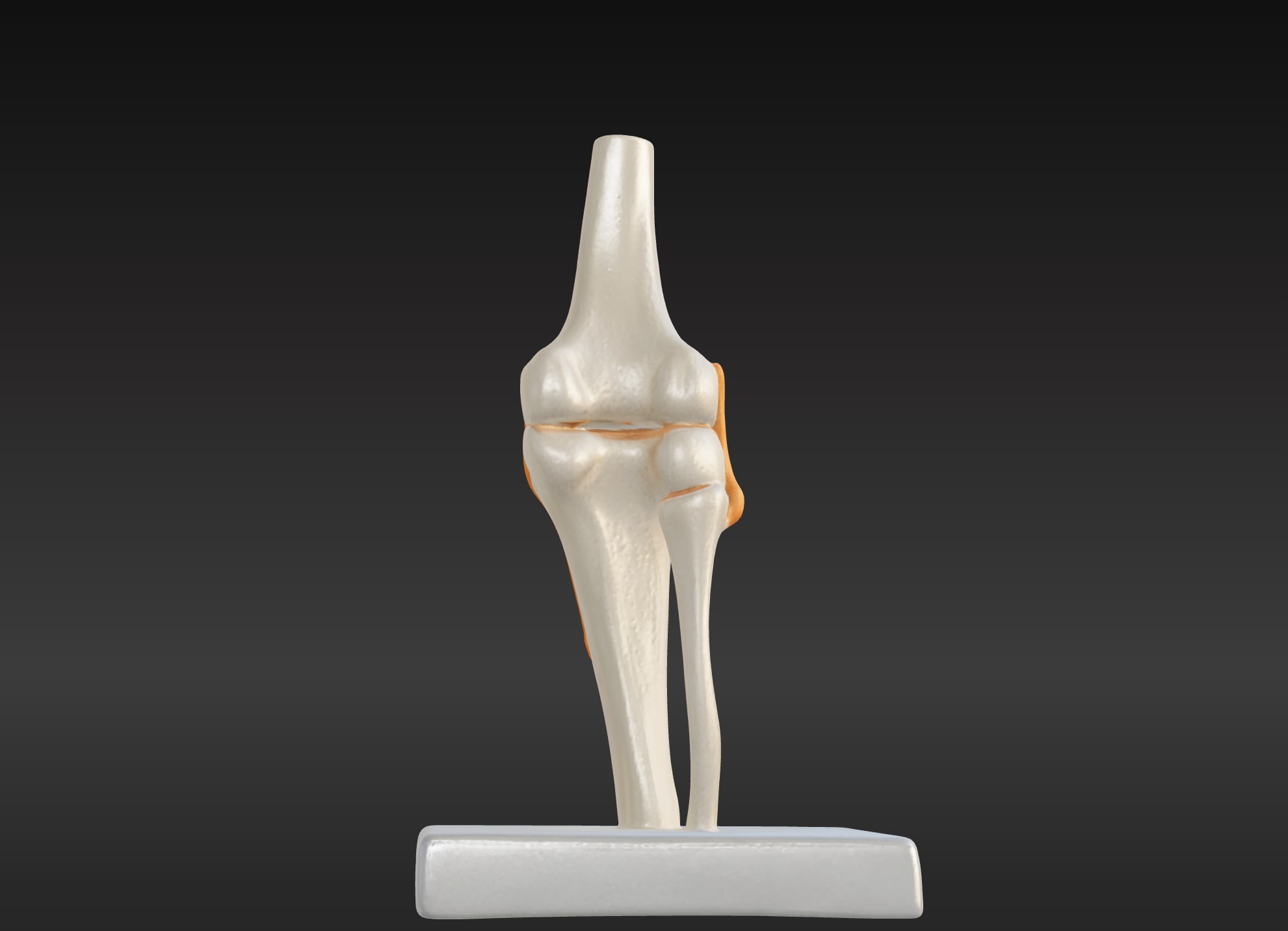 3D Joint Anatomy Model Set with Stand - 4 pack 3D print model_34