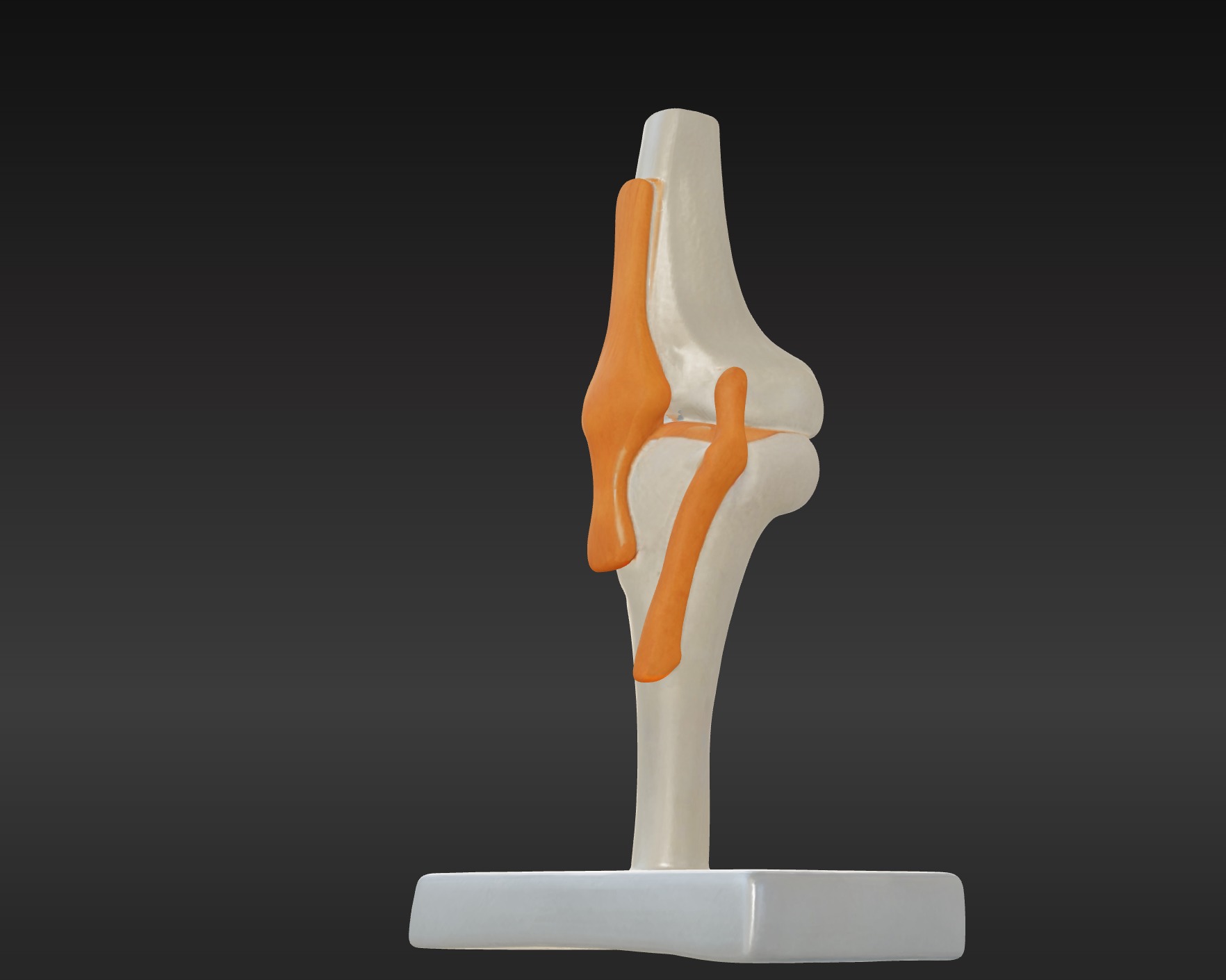 3D Joint Anatomy Model Set with Stand - 4 pack 3D print model_32