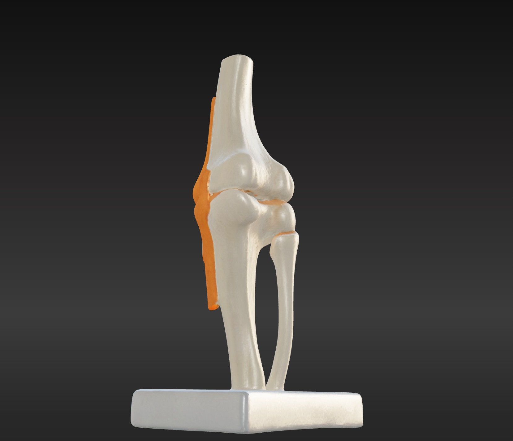 3D Joint Anatomy Model Set with Stand - 4 pack 3D print model_33