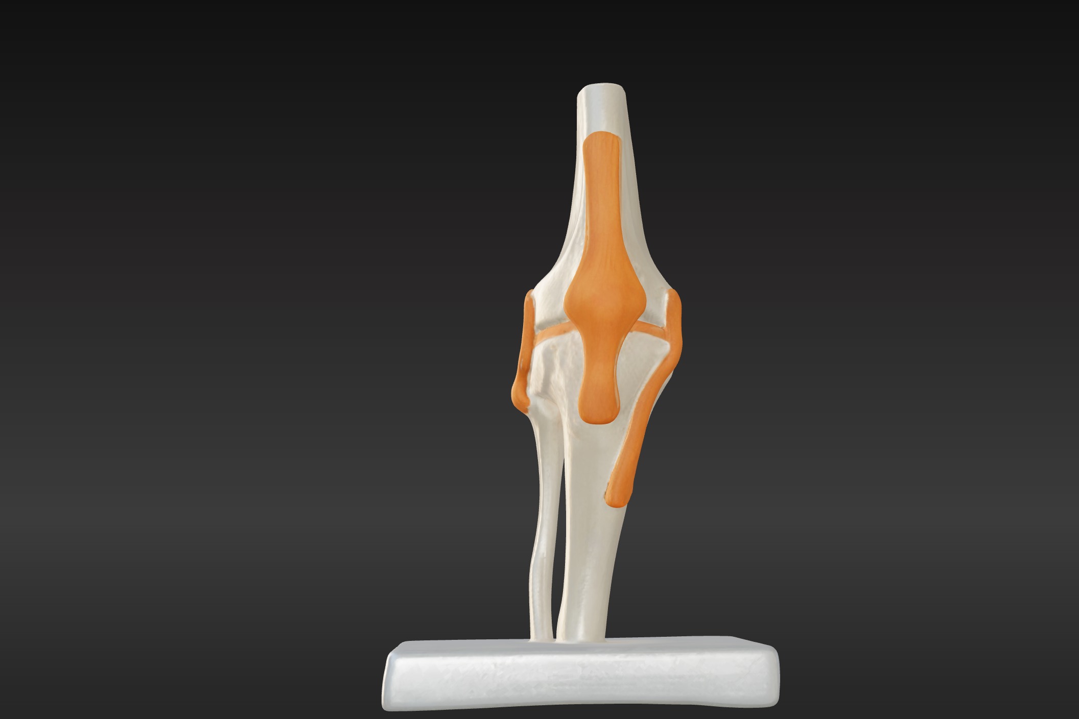 3D Joint Anatomy Model Set with Stand - 4 pack 3D print model_29