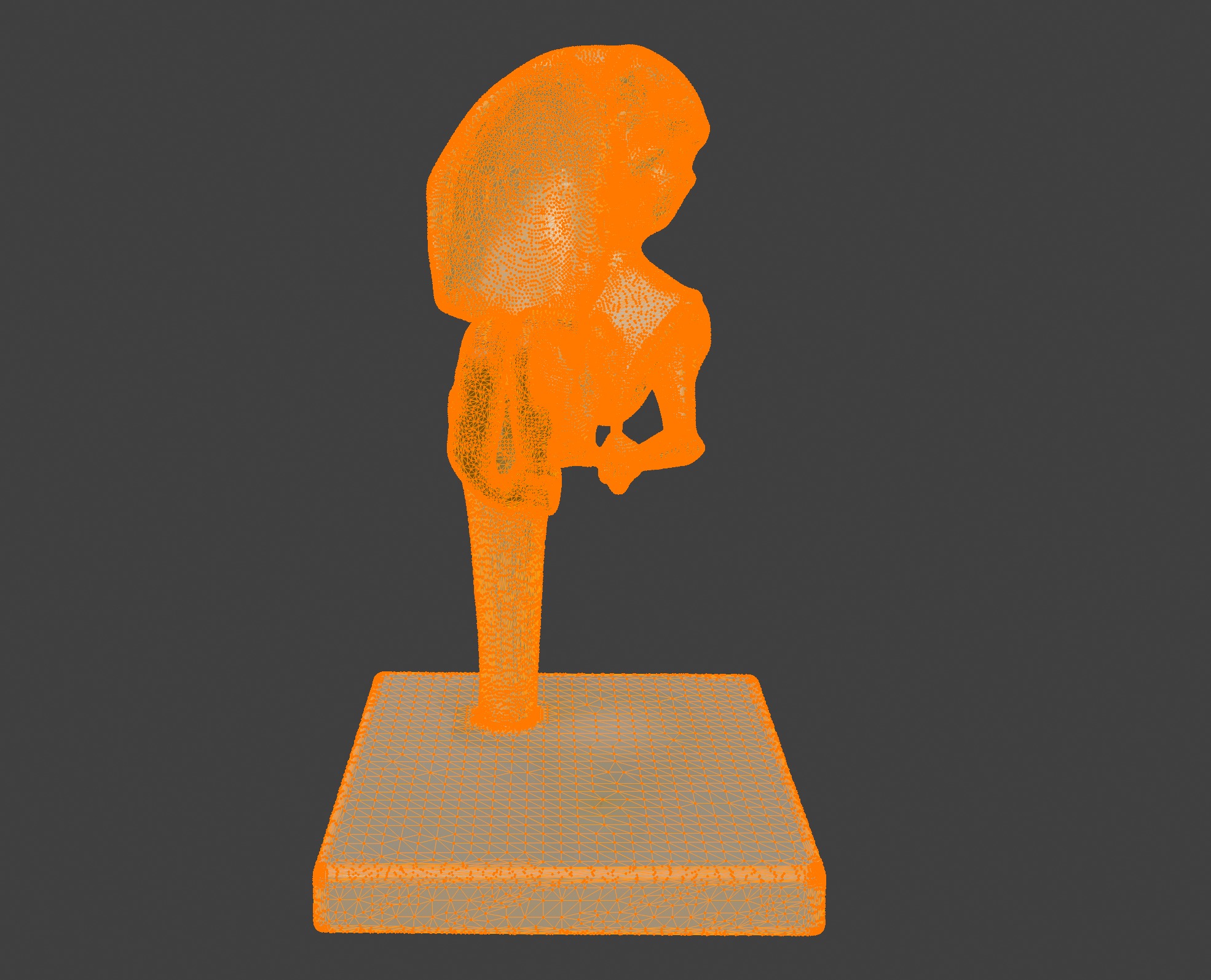 3D Joint Anatomy Model Set with Stand - 4 pack 3D print model_18