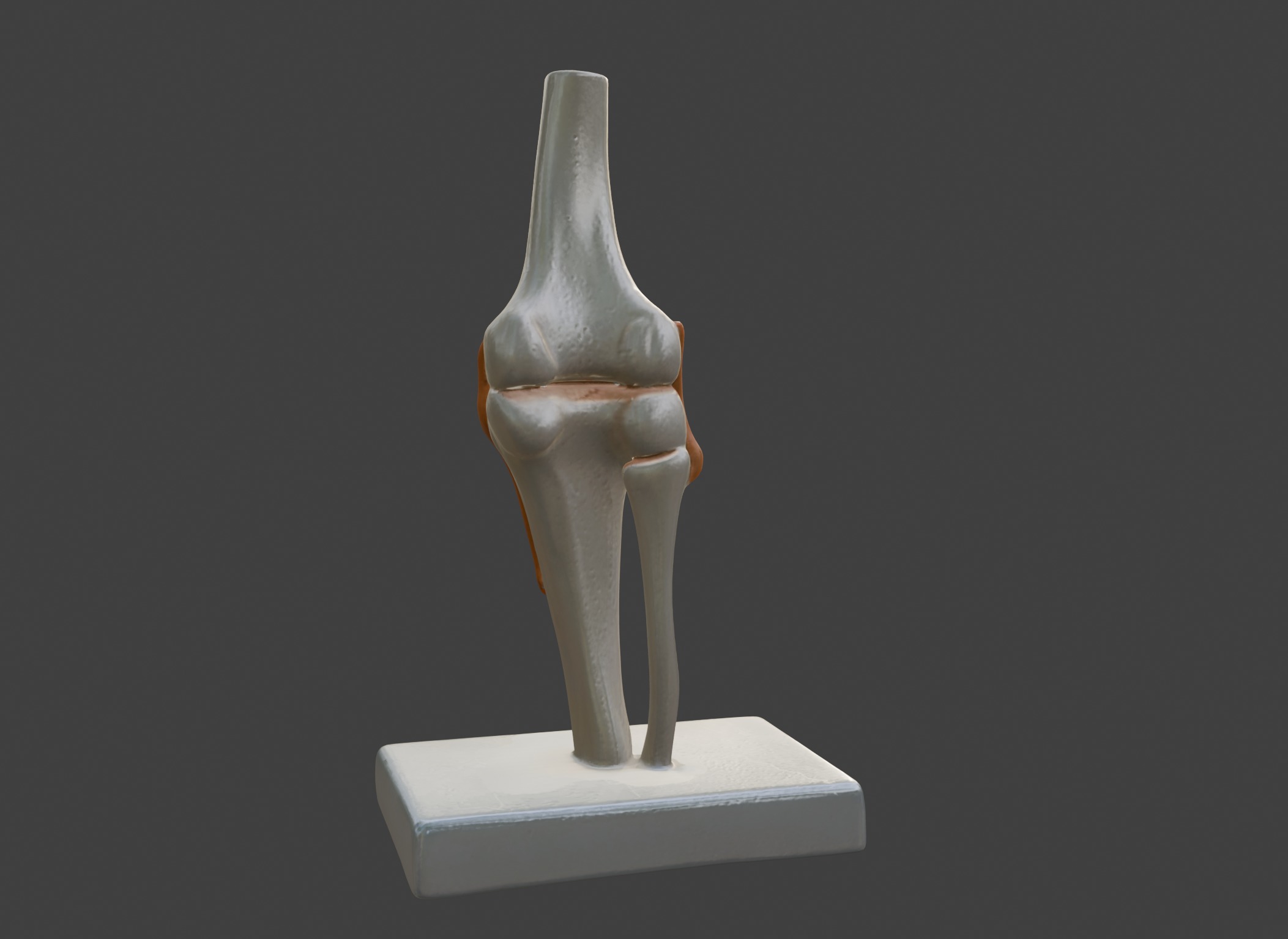 3D Joint Anatomy Model Set with Stand - 4 pack 3D print model_37