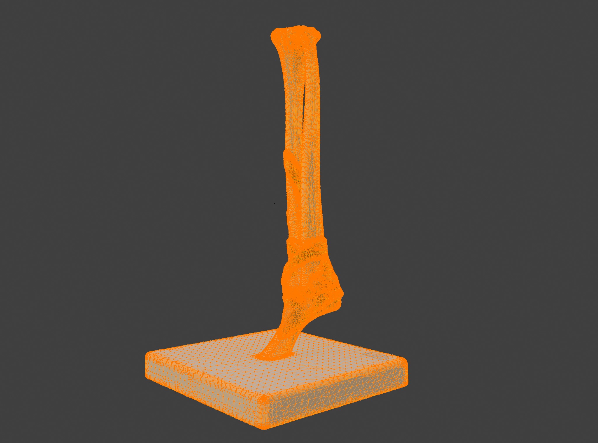 3D Joint Anatomy Model Set with Stand - 4 pack 3D print model_42