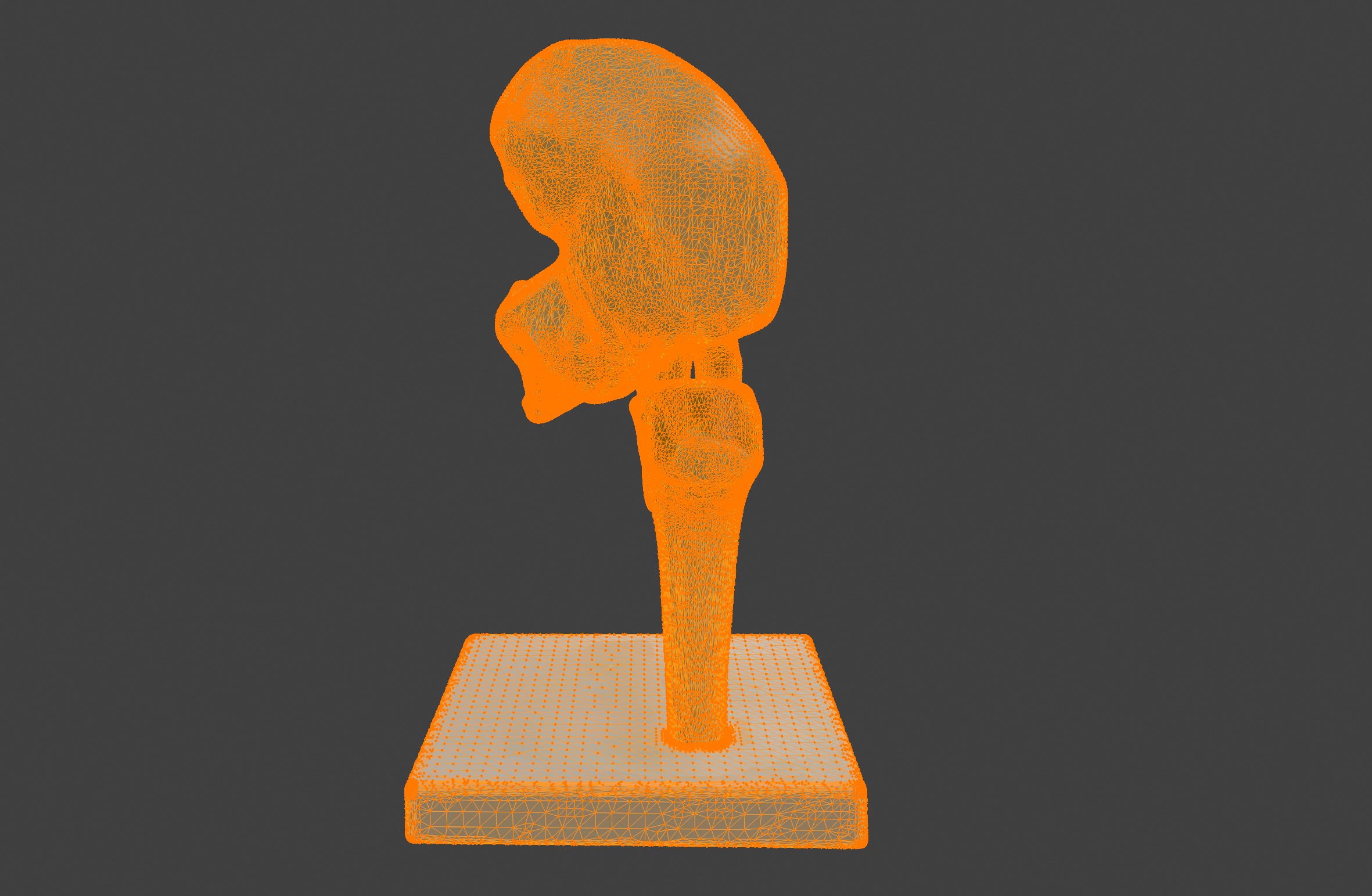 3D Joint Anatomy Model Set with Stand - 4 pack 3D print model_27