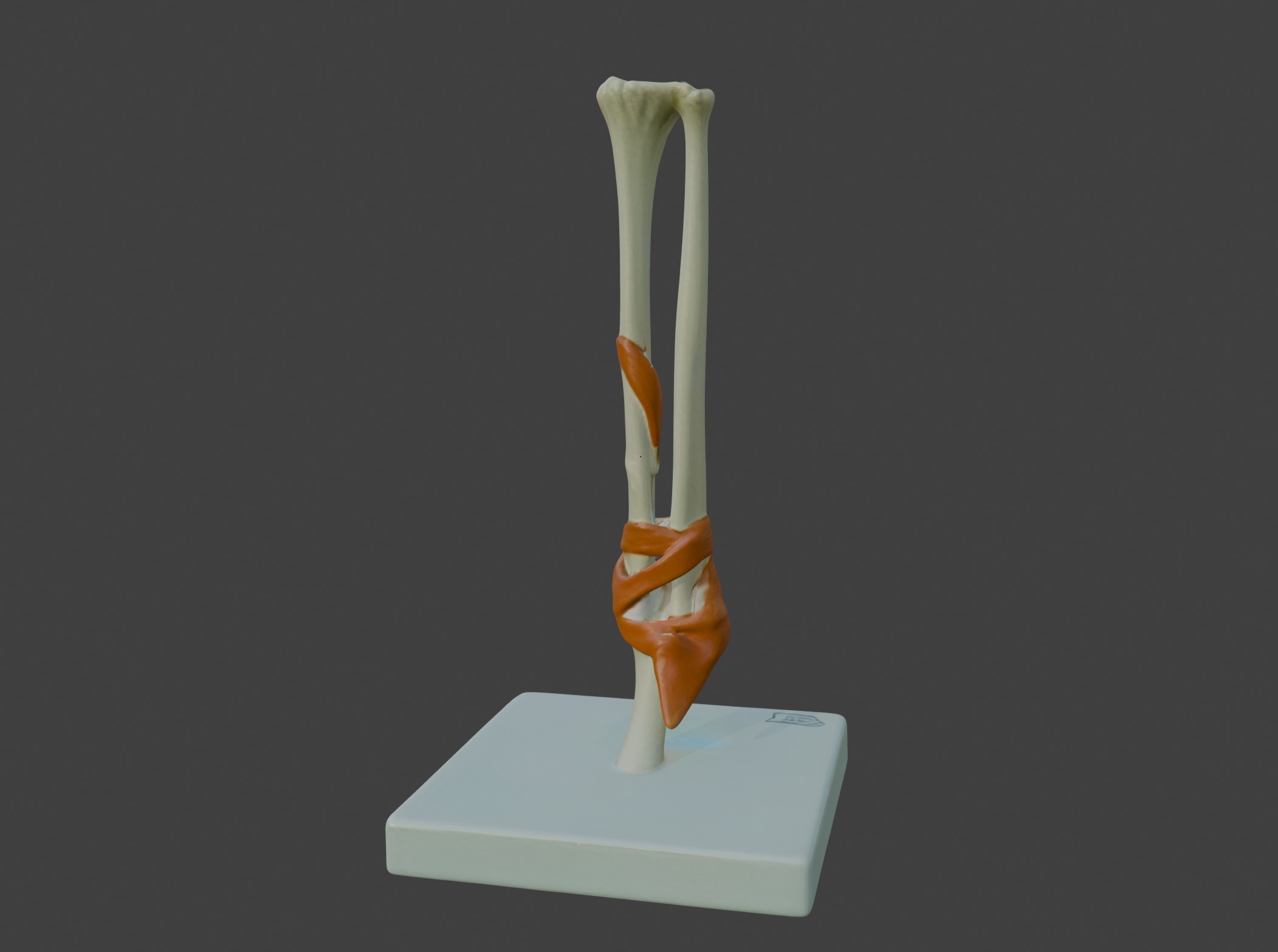 3D Joint Anatomy Model Set with Stand - 4 pack 3D print model_51