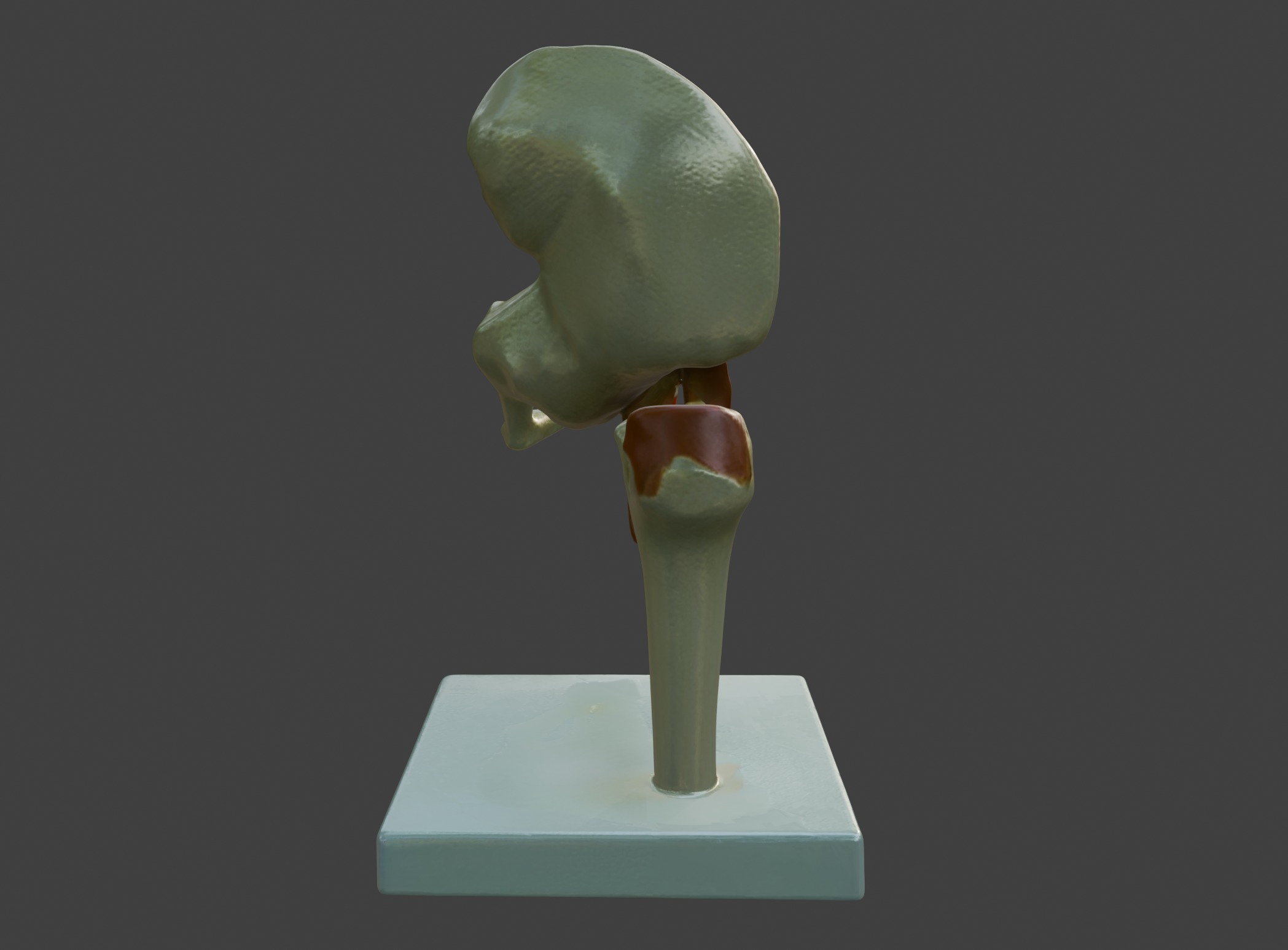 3D Joint Anatomy Model Set with Stand - 4 pack 3D print model_26