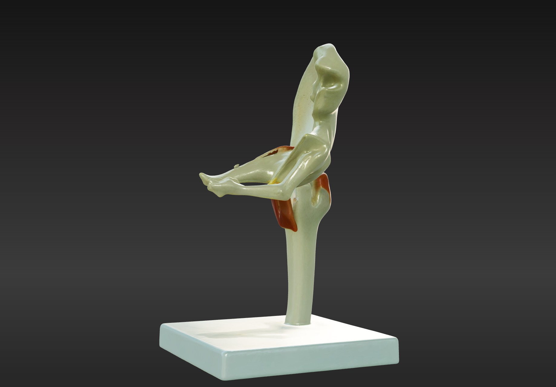 3D Joint Anatomy Model Set with Stand - 4 pack 3D print model_20