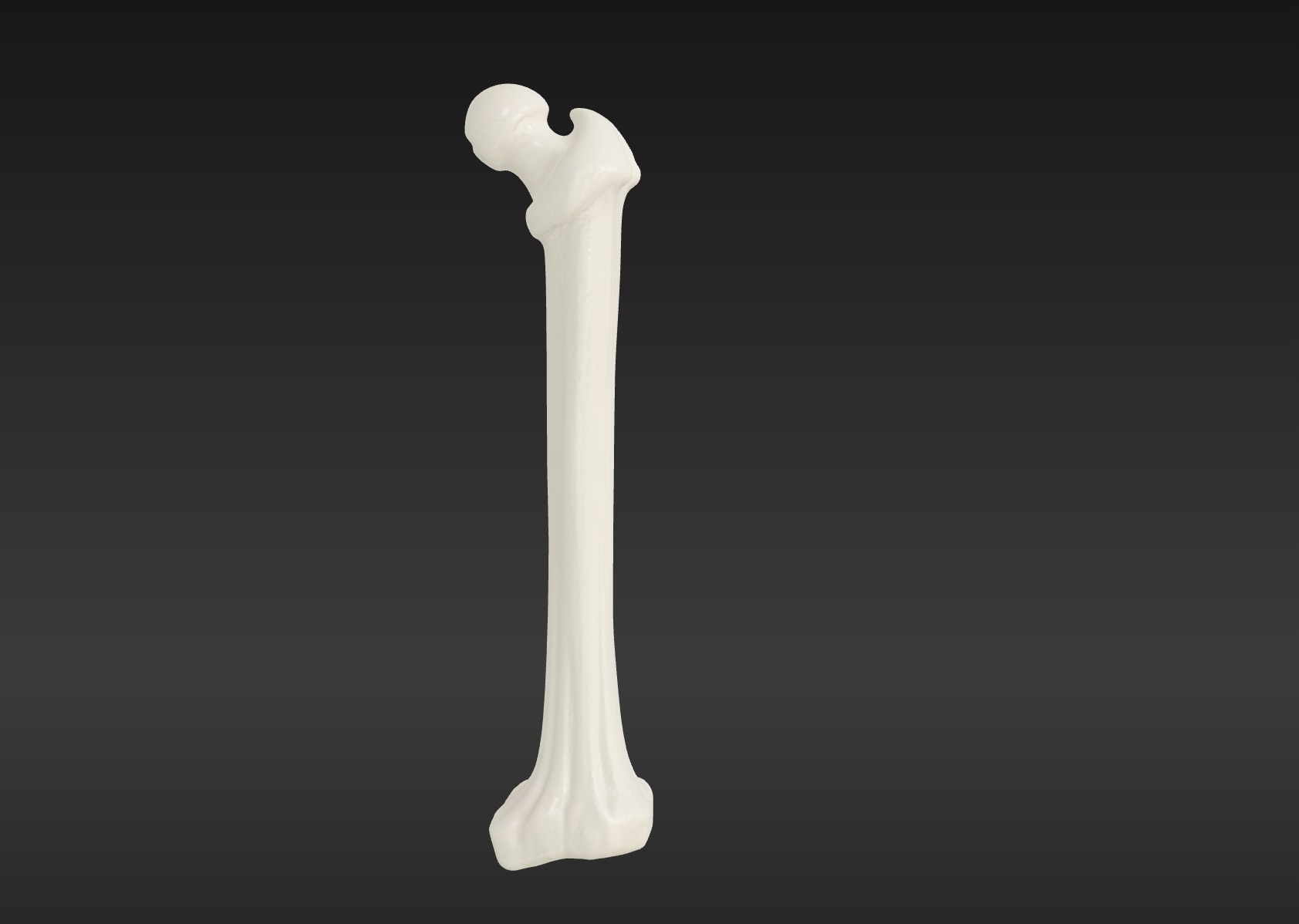 3D Femur Bone Model 3D print model_2