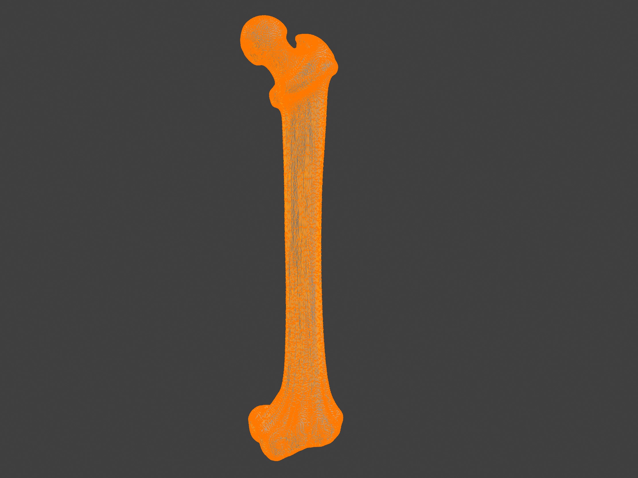 3D Femur Bone Model 3D print model_5