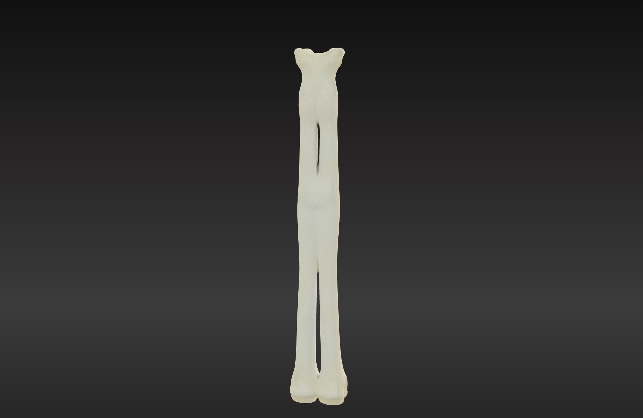 3D Model of Radius Bone 3D print model_1