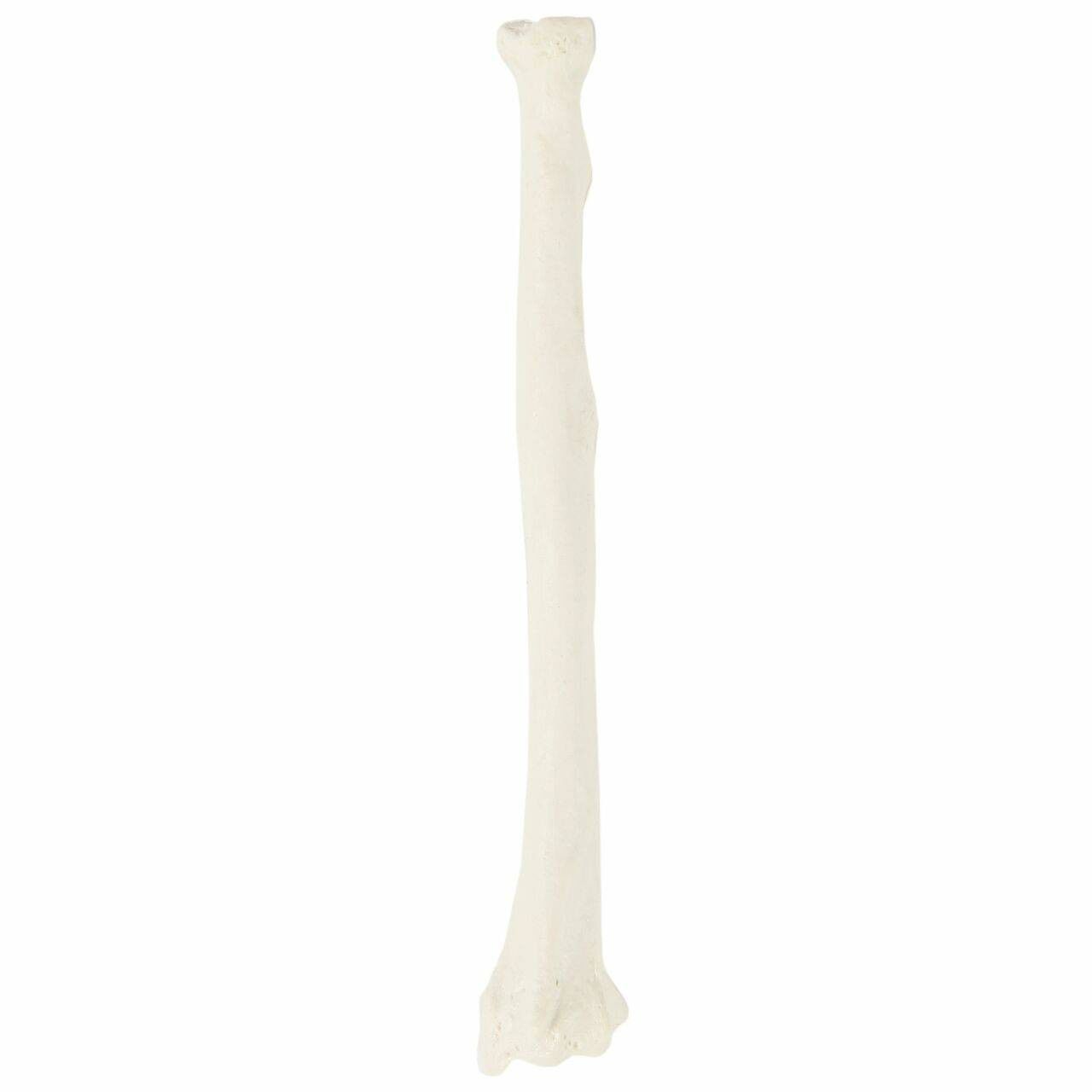 3D Model of Radius Bone 3D print model_11