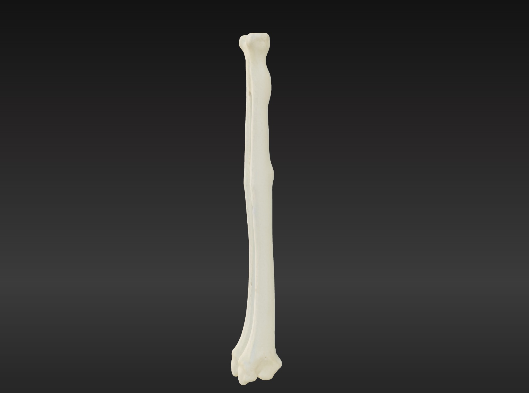 3D Model of Radius Bone 3D print model_2