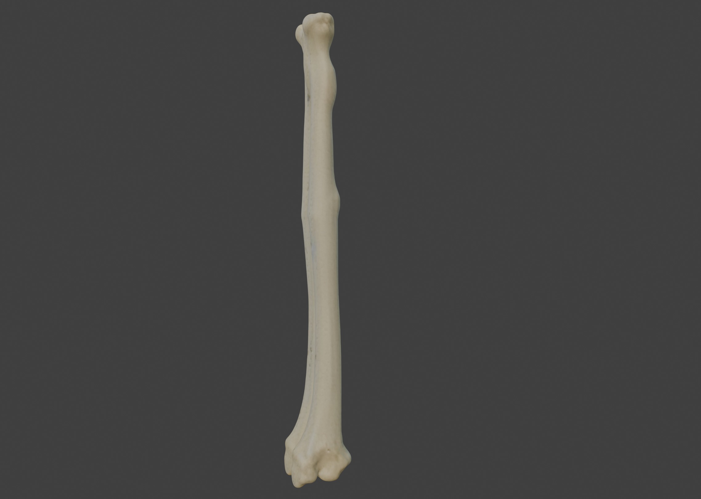 3D Model of Radius Bone 3D print model_4