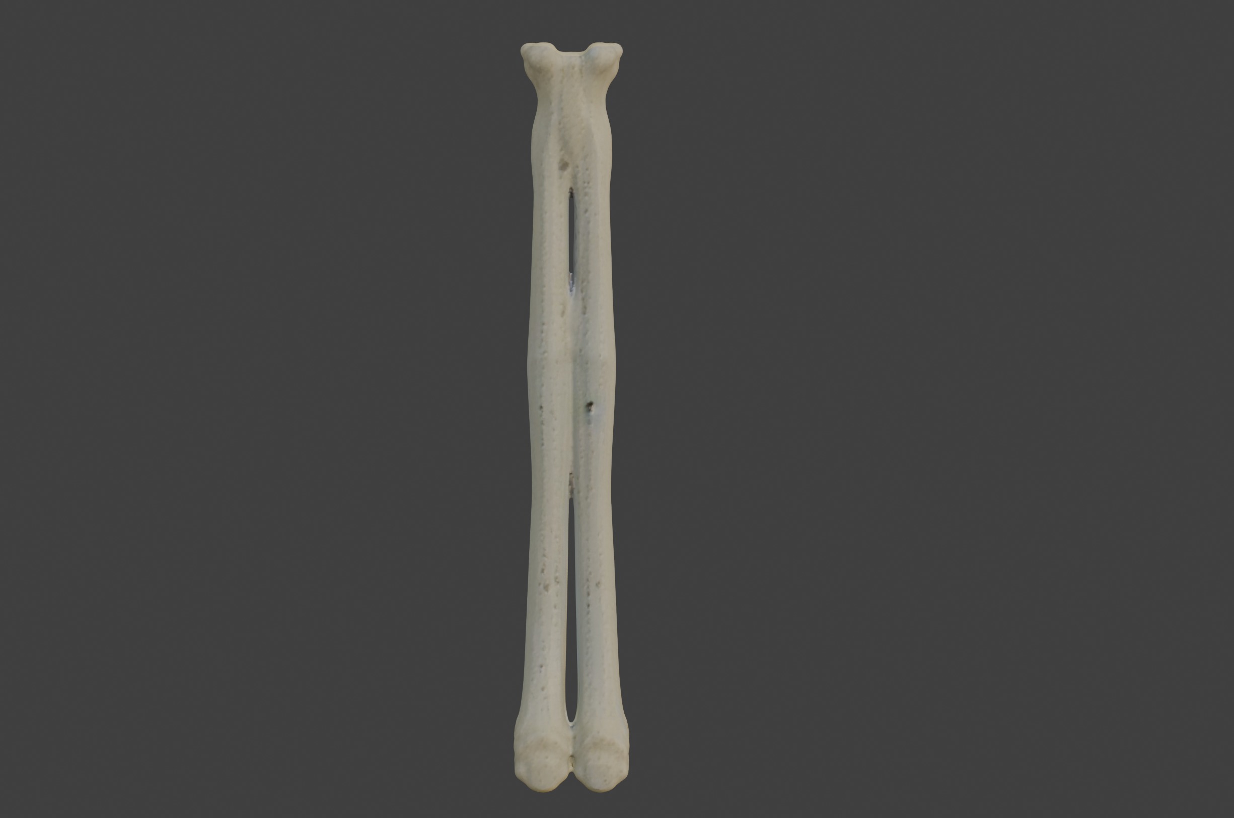 3D Model of Radius Bone 3D print model_5