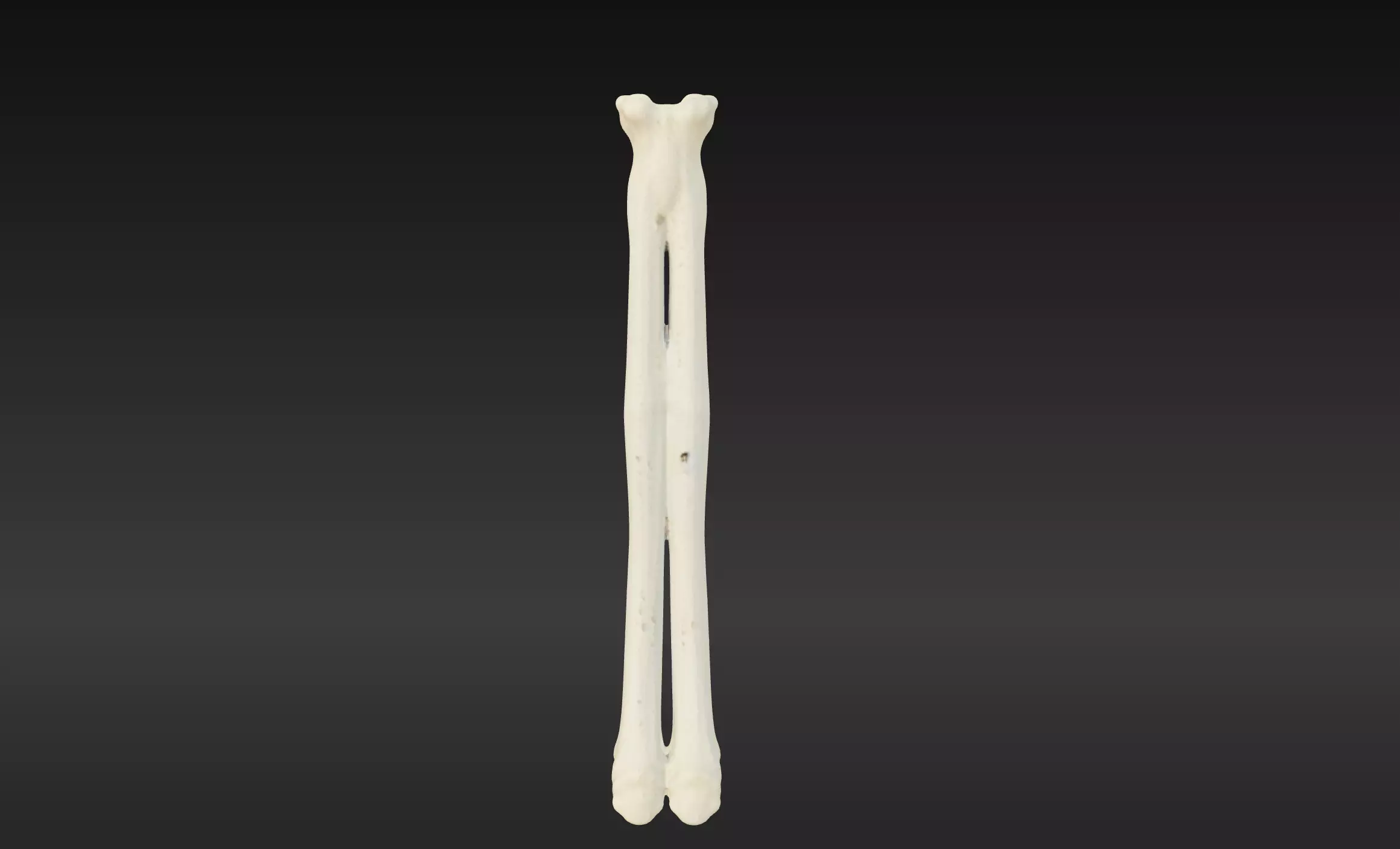 3D Model of Radius Bone 3D print model_0