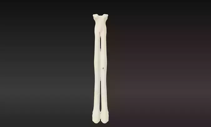 3D Model of Radius Bone