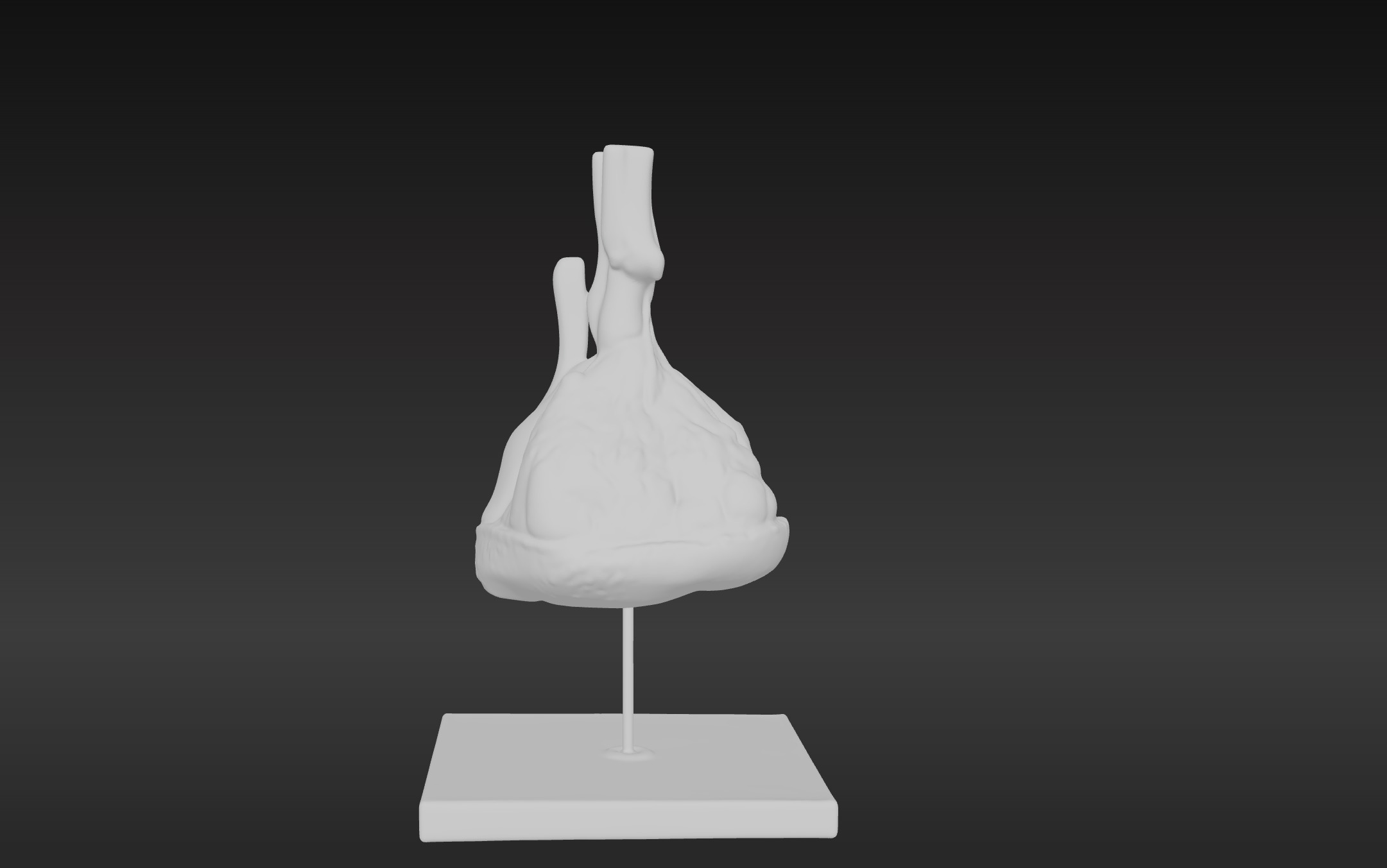 3D Model of Pulmonary Lobule  3D print model_7