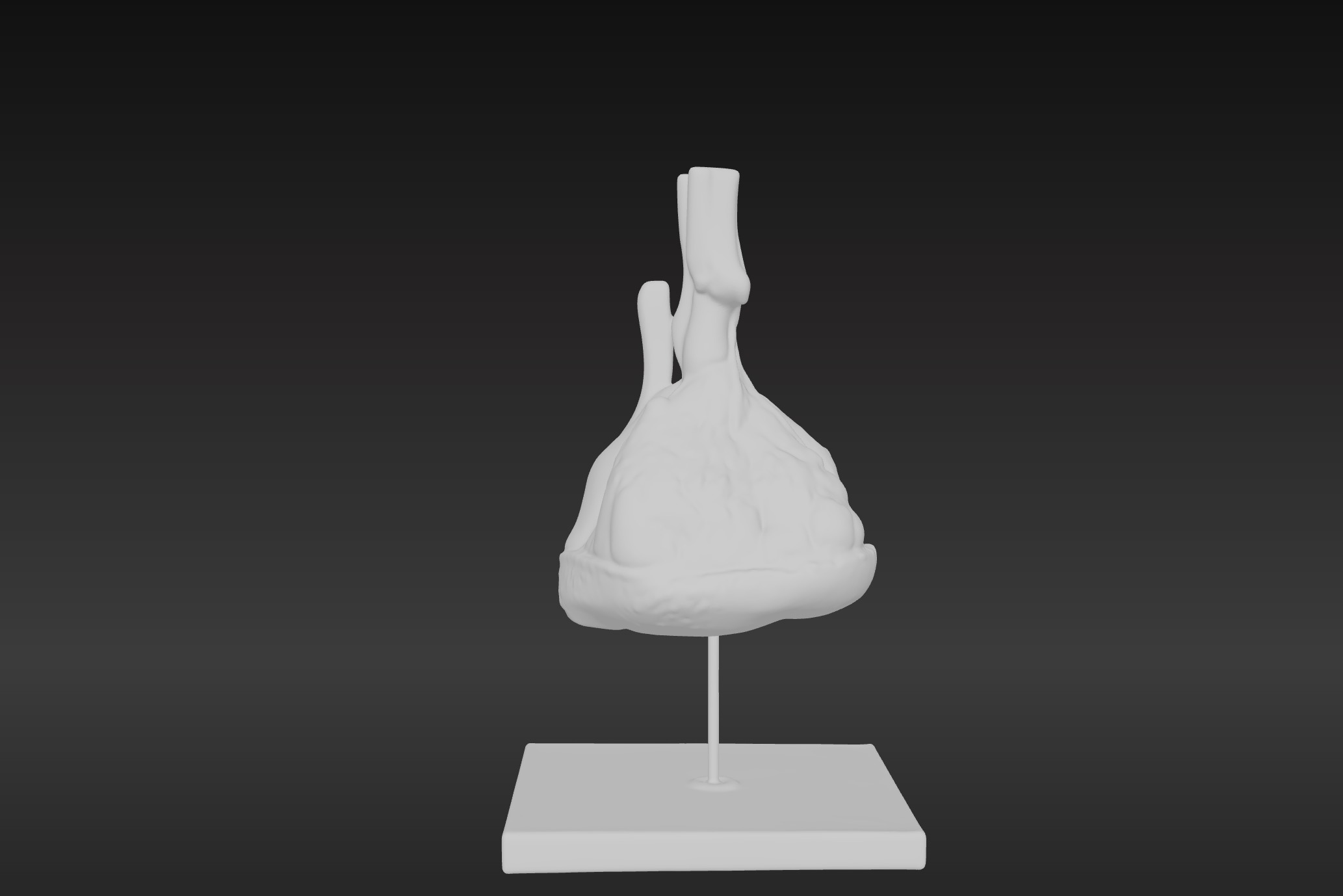 3D Model of Pulmonary Lobule  3D print model_8