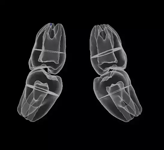 Third molars set with root canal      2 pieces version 3D print model