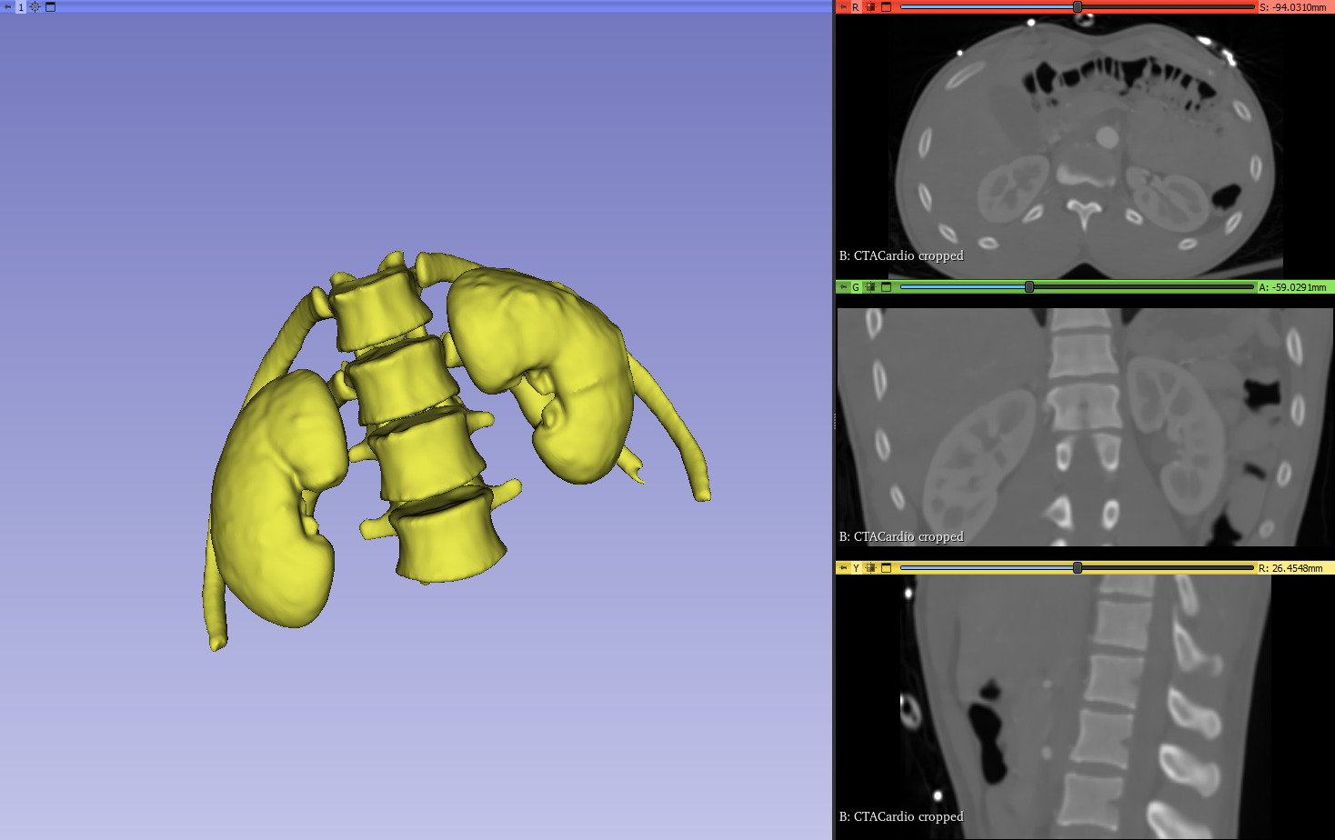 Kidneys and ureters 3D print model_4