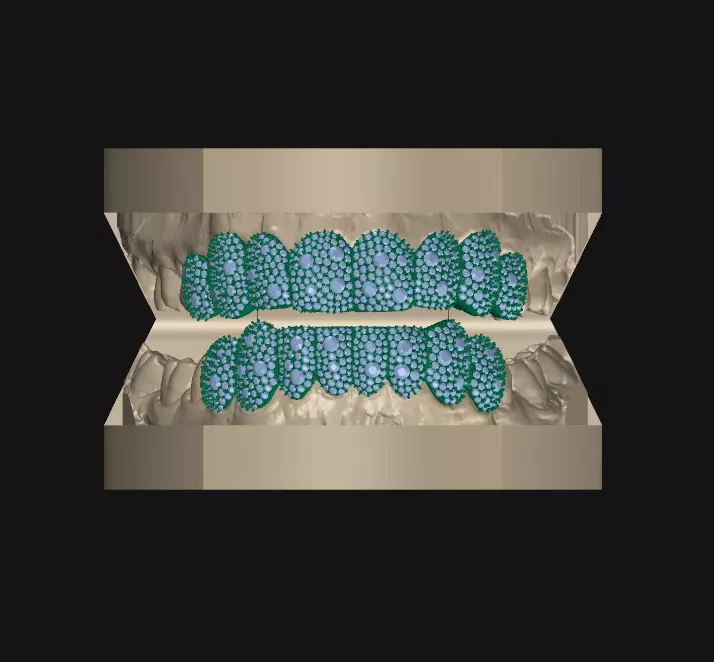 Grillz mosaic setting 8x8 3D print model_0