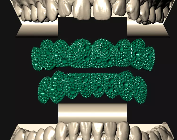 Grillz mosaic setting 8x8 3D print model_2