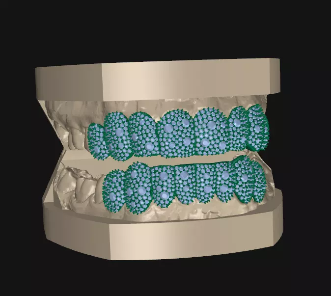 Grillz mosaic setting 8x8 3D print model_1