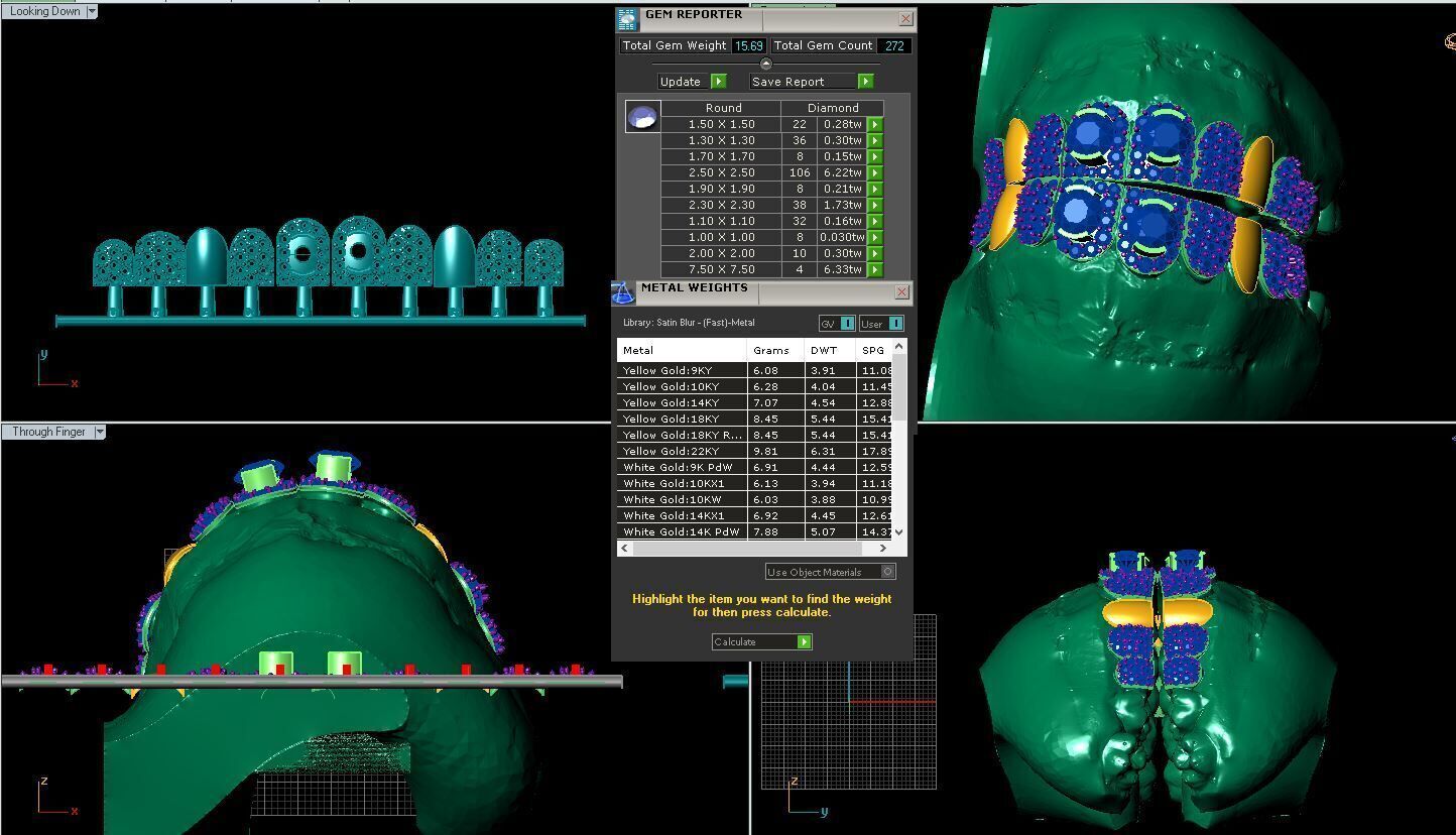 tooth decoration 3D model_1