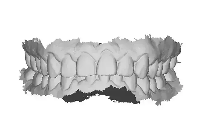 P002 - Dental - Intraoral Scan STL-PLY-OBJ 3D print model