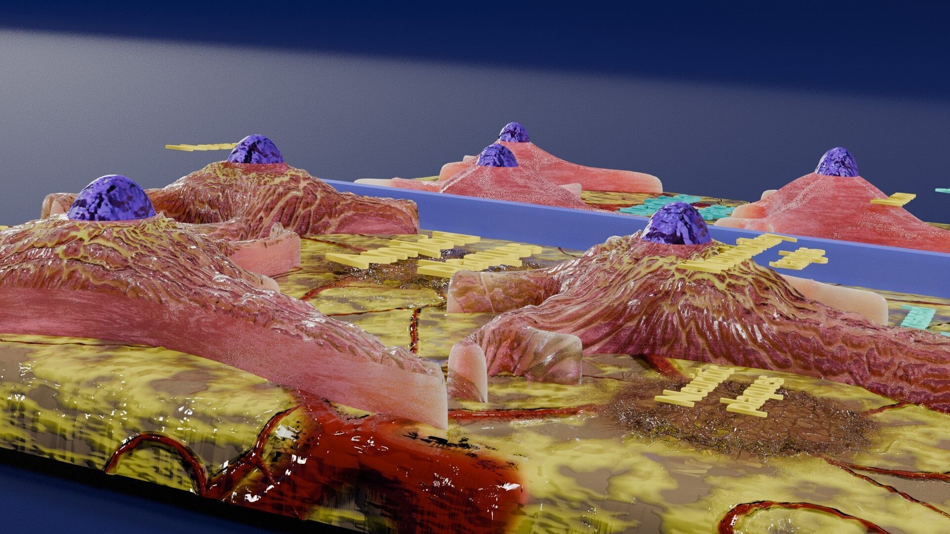 Alzheimer disease microscopy changes brain Low-poly 3D model_17