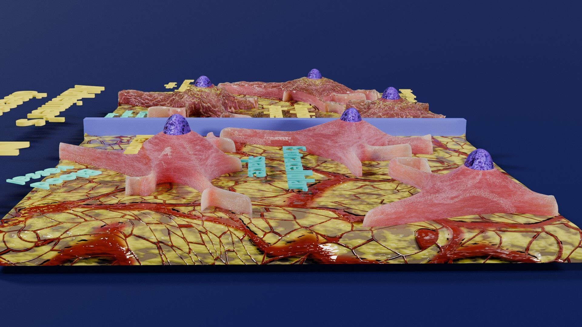 Alzheimer disease microscopy changes brain Low-poly 3D model_7