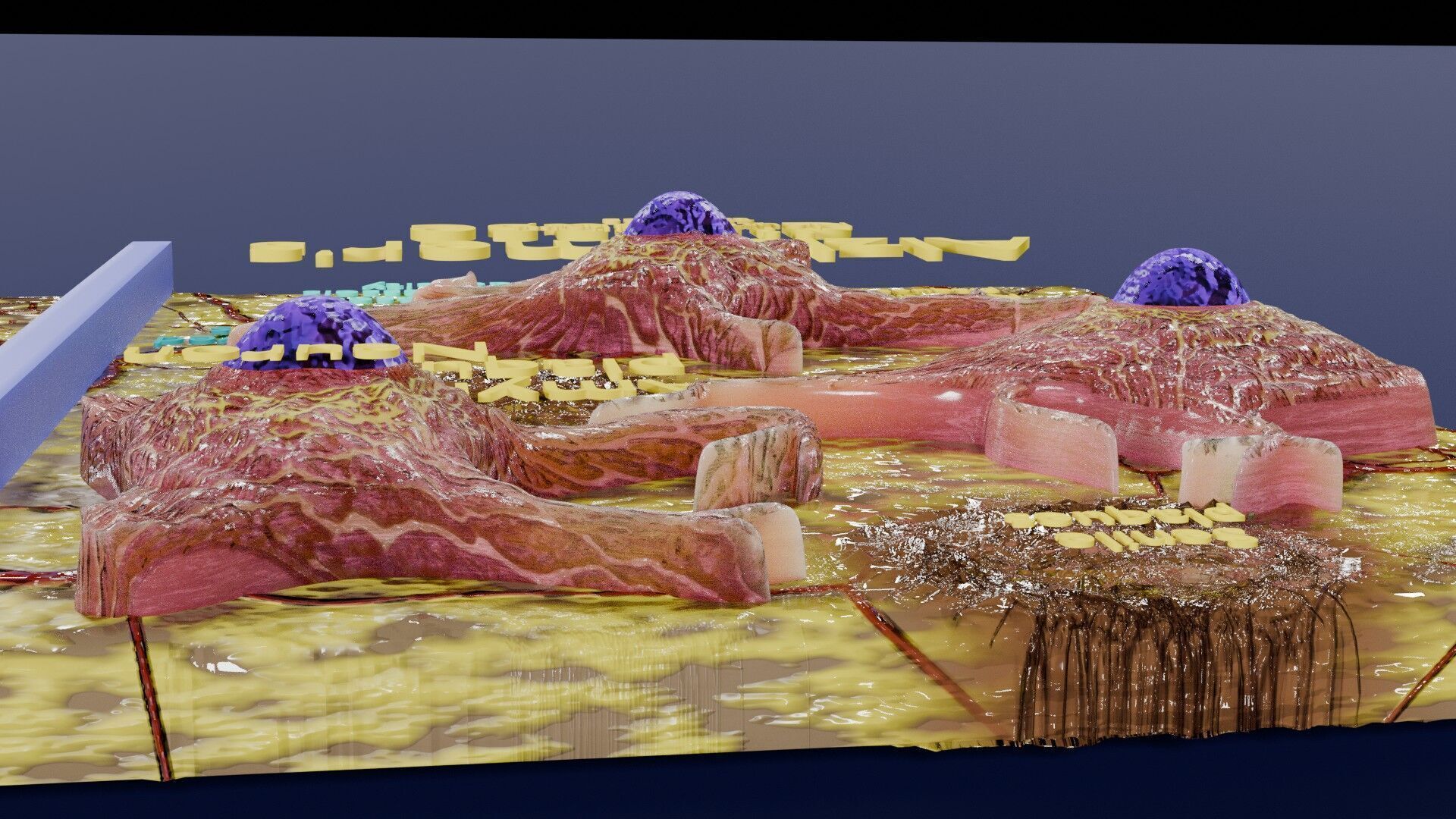 Alzheimer disease microscopy changes brain Low-poly 3D model_10