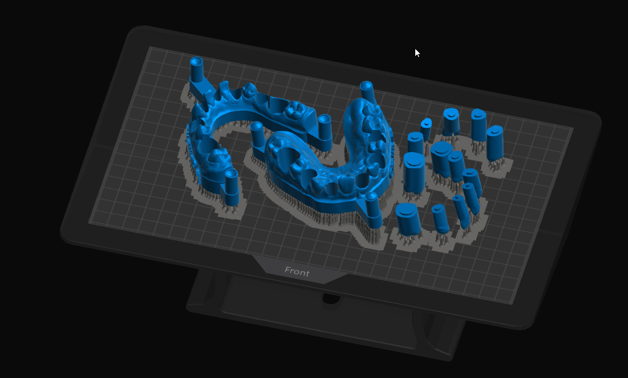 Study model With Removable Pin Dies 3D print model_2