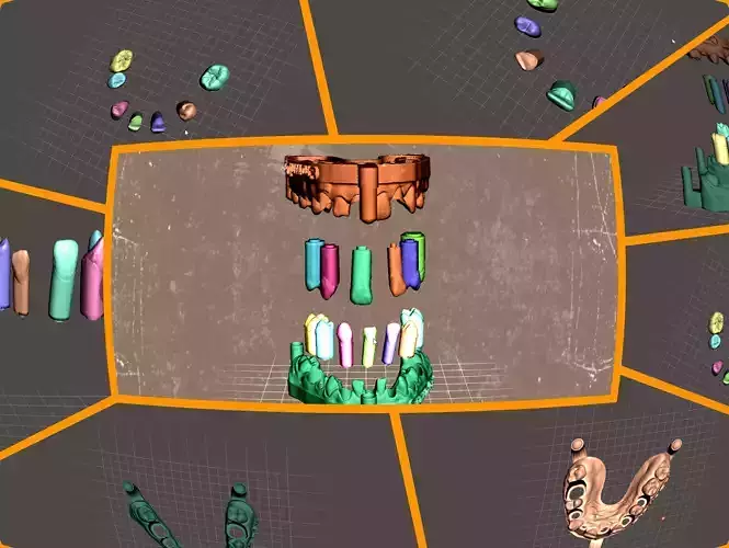 Study model With Removable Pin Dies